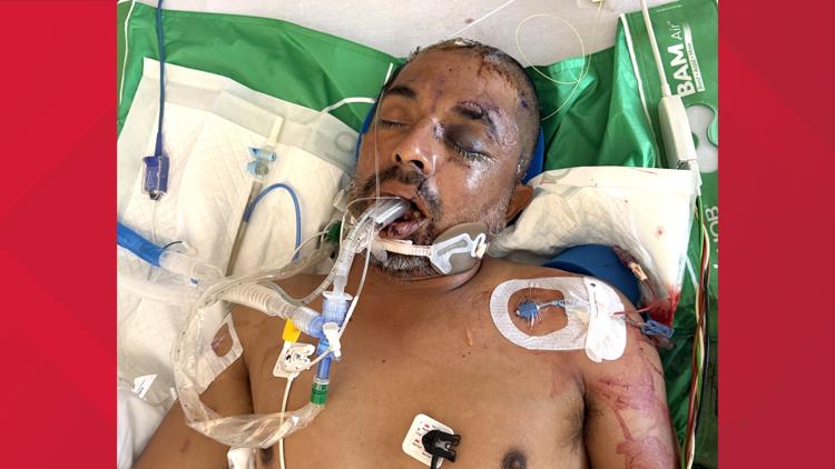 University Hospital asks for help identifying unconscious patient hit by truck Saturday evening — KENS 5 (San Antonio), Woodbury Health news